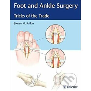 Foot and Ankle Surgery - Steven Raikin