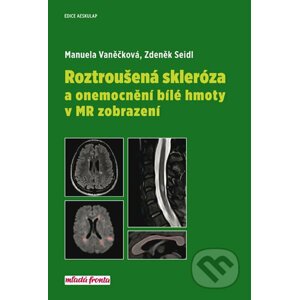 Roztroušená skleróza a onemocnění bílé hmoty v MR zobrazení - Manuela Vaněčková, Zdeněk Seidl