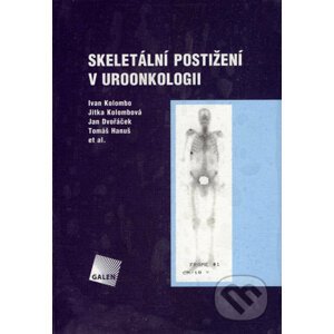Skeletální postižení v uroonkologii - Ivan Kolombo, Jitka Kolombová, Jan Dvořáček, Tomáš Hanuš