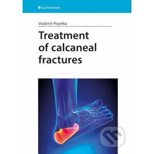 Treatment of calcaneal fractures - Vladimír Popelka