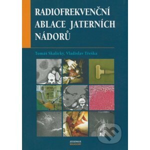 Radiofrekvenční ablace jaterních nádorů - Tomáš Skalický, Vladislav Třeška