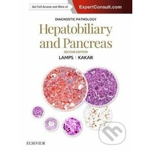 Diagnostic Pathology: Hepatobiliary and Pancreas - Sanjay Kakar, Laura W. Lamps