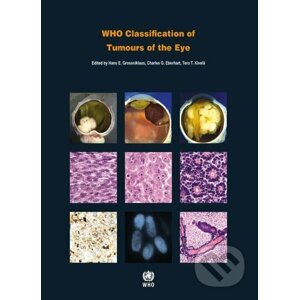 WHO Classification of Tumours of the Eye - World Health Organization