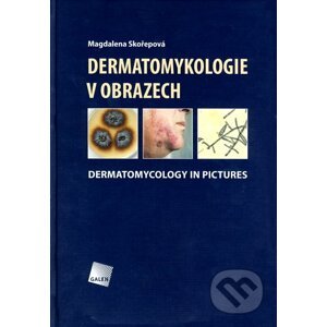Dermatomykologie v obrazech - Magdalena Skořepová