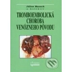 Tromboembolická choroba venózneho pôvodu - Július Mazuch a kol.