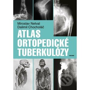 E-kniha Atlas ortopedické tuberkulózy - Dalimil Chocholáč, Miroslav Netval
