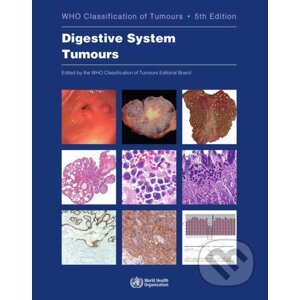 Who Classification of Tumours: Digestive System Tumours - World Health Organization