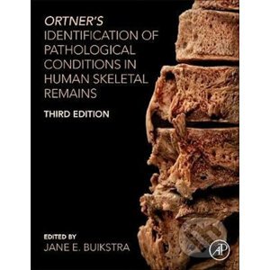 Ortner's Identification of Pathological Conditions in Human Skeletal Remains - E. Jane Buikstr