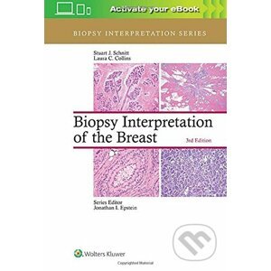 Biopsy Interpretation of the Breast - Lippincott Williams & Wilkins