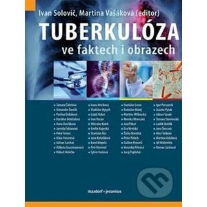 Tuberkulóza ve faktech i obrazech - Ivan Solovič