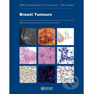Who Classification of Tumours: Breast Tumours - World Health Organization