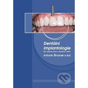 Dentální implantologie - Antonín Šimůnek