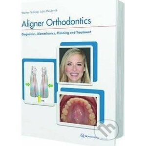 Aligner Orthodontics - Werner Schup, Julia Haubrich