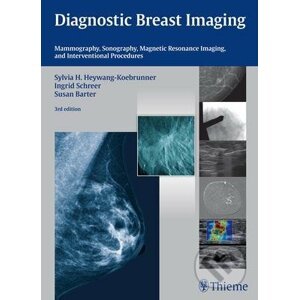 Diagnostic Breast Imaging - Sylvia H. Heywang-Koebrunner, Ingrid Schreer, Susan Barter