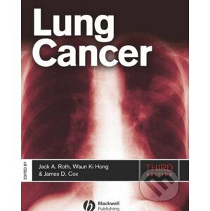 Lung Cancer - Jack A. Roth, James D. Cox, Waun Ki Hong