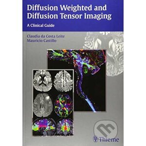 Diffusion Weighted and Diffusion Tensor Imaging - Claudia Leite, Mauricio Castillo