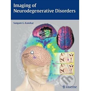 Imaging of Neurodegenerative Disorders - Sangam G. Kanekar