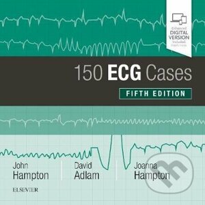 150 ECG Cases - John Hampton, David Adlam, Joanna Hampton