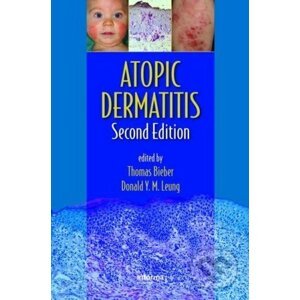 Atopic Dermatitis - Thomas Bieber, Donald Y.M. Leung