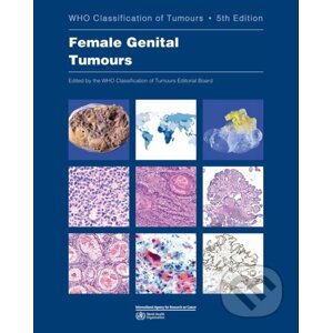 Female Genital Tumours - World Health Organization