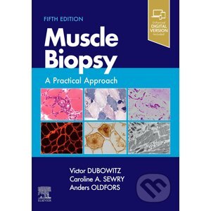 Muscle Biopsy - Victor Dubowitz Caroline Sewry Anders Oldfors