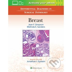 Differential Diagnoses in Surgical Pathology: Breast - Jean F. Simpson, Melinda E. Sanders