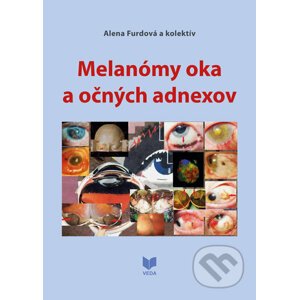 Melanómy oka a očných adnexov - Alena Furdová a kolektív