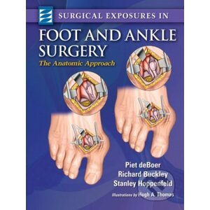 Surgical Exposures in Foot & Ankle Surgery - Piet Deboer