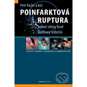 Poinfarktová ruptura - Petr Kačer a kolektív autorov