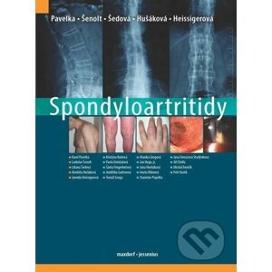 Spondyloartritidy - Karel Pavelka, Ladislav Šenolt, Liliana Šedová