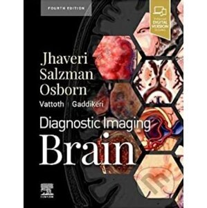 Diagnostic Imaging: Brain - Miral D. Jhaveri