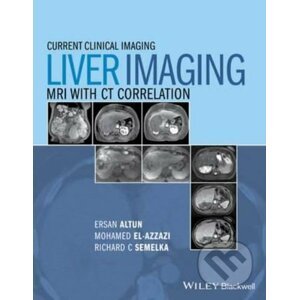 Liver Imaging - Ersan Altun, Mohamed Elazzazi, Richard C. Semelka, Larissa Braga
