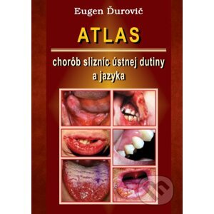 Atlas chorôb slizníc ústnej dutiny a jazyka - Eugen Ďurovič