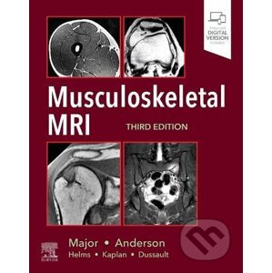 Musculoskeletal MRI - Nancy M. Major, Mark W. Anderson